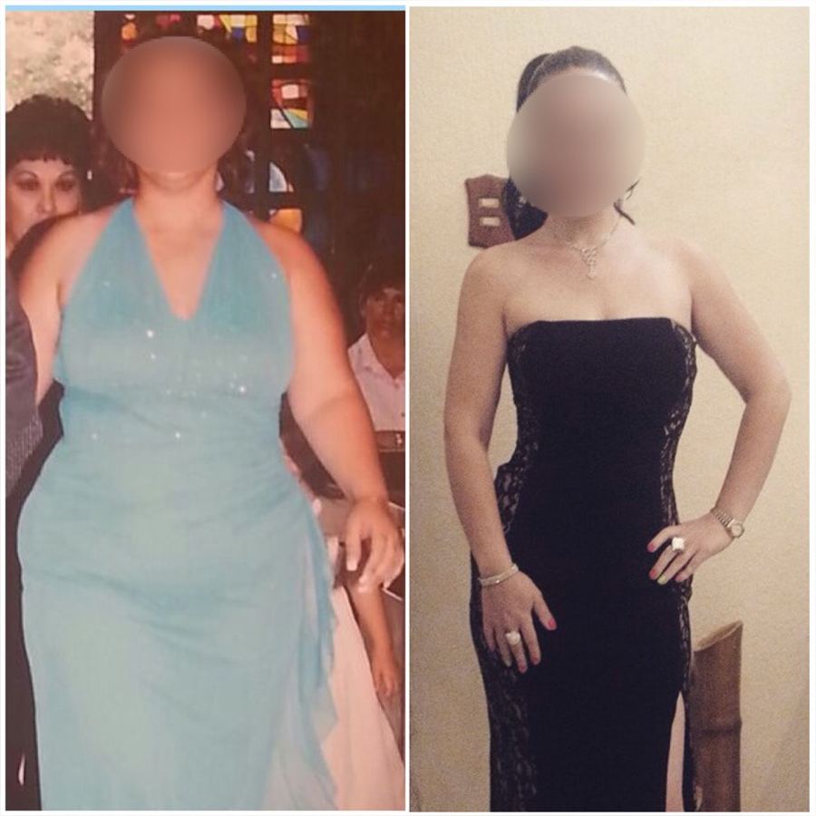 Paciente antes y después de su tratamiento, caso 4