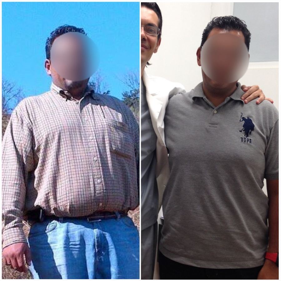 Paciente antes y después de su tratamiento, caso 6