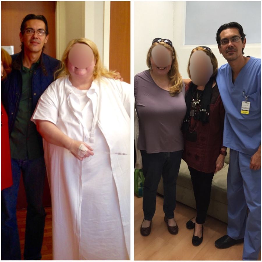 Paciente antes y después de su tratamiento, caso 7