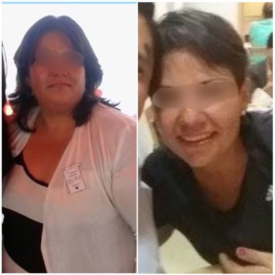 Paciente antes y después de su tratamiento, caso 8