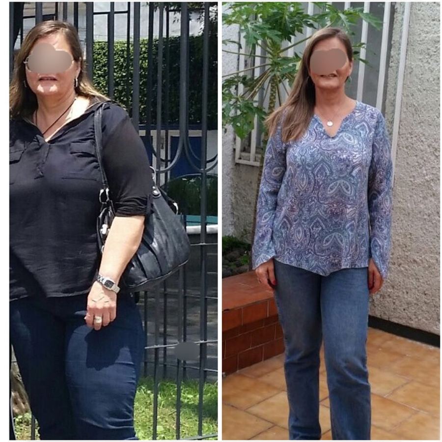 Paciente antes y después de su tratamiento, caso 9