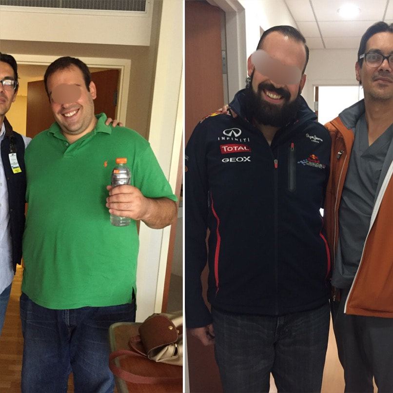 Paciente antes y después de su tratamiento, caso 12